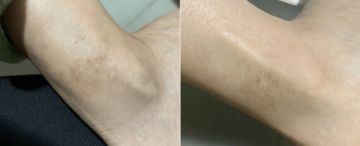 right ankle right ankle